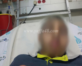 بالصور: إصابة متوسطة لطفل بحادث دهس "ضرب وهرب" في مدينة يافا 